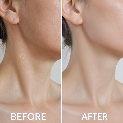 Máquina Facial & Cuello con Luz LED | Masajeador Térmico 3 en 1